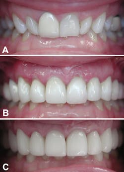 Fagin Temps02 Fig10 Fagin Temps02 Fig10
