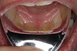 Pmm Reflective Shields Plus Fig02 Pmm Reflective Shields Plus Fig02