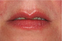 Stonisch Fig01 Stonisch Fig01