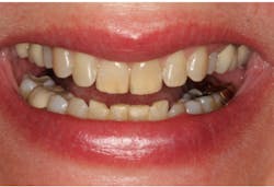 Stonisch Fig02 Stonisch Fig02