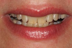 Stonisch Fig03 Stonisch Fig03