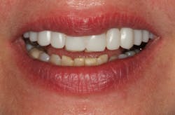 Stonisch Fig04 Stonisch Fig04