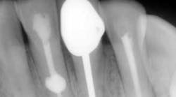 Content Dam Diq Online Articles 2017 07 Kinra Thumb Content Dam Diq Online Articles 2017 07 Kinra Thumb