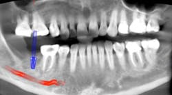 Content Dam Diq Online Articles 2017 07 X Ray 1 Content Dam Diq Online Articles 2017 07 X Ray 1