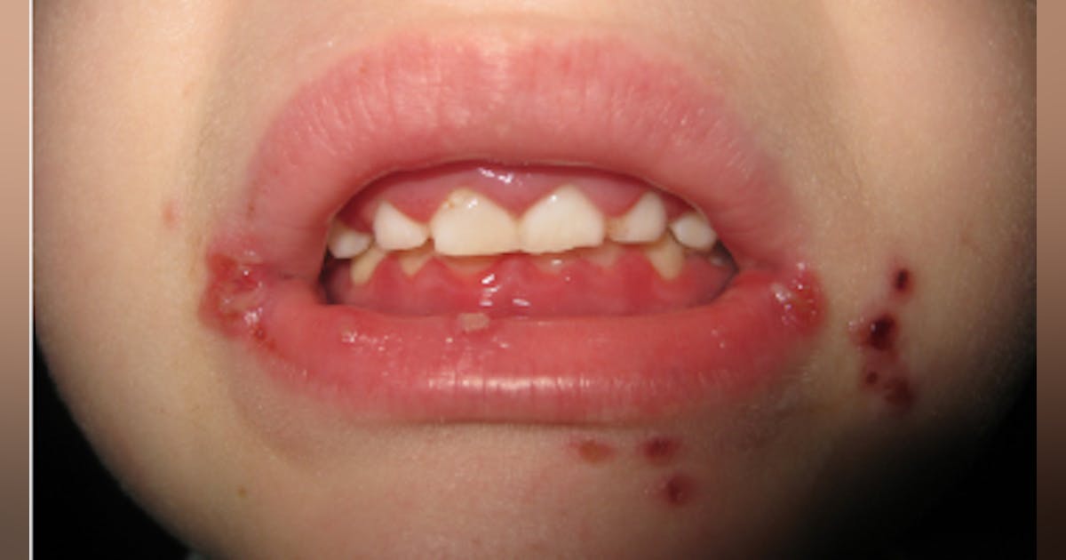 Breakthrough Clinical oral pathology case: No. 29 | Dentistry IQ