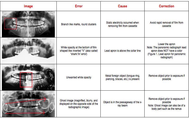 Radiographic In Dental Radiography Errors