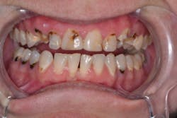 17aug3bcjohnson P01 17aug3bcjohnson P01