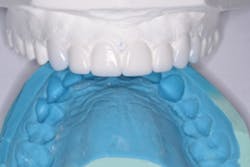 17aug3bcjohnson P03 17aug3bcjohnson P03