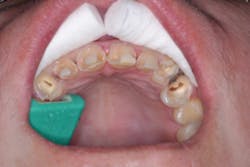 17aug3bcjohnson P05 17aug3bcjohnson P05