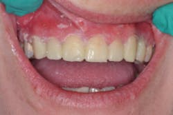 17aug3bcjohnson P06 17aug3bcjohnson P06