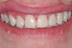 17aug3bcjohnson P07 17aug3bcjohnson P07