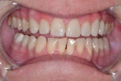 17aug3bcjohnson P08 17aug3bcjohnson P08