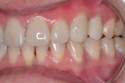 17aug3bcjohnson P09 17aug3bcjohnson P09