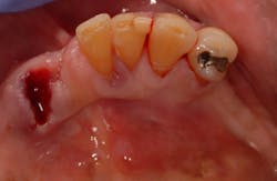 17aug3bcpaghdiwala P01 17aug3bcpaghdiwala P01