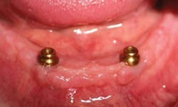 17aug3bcpaghdiwala P04 17aug3bcpaghdiwala P04