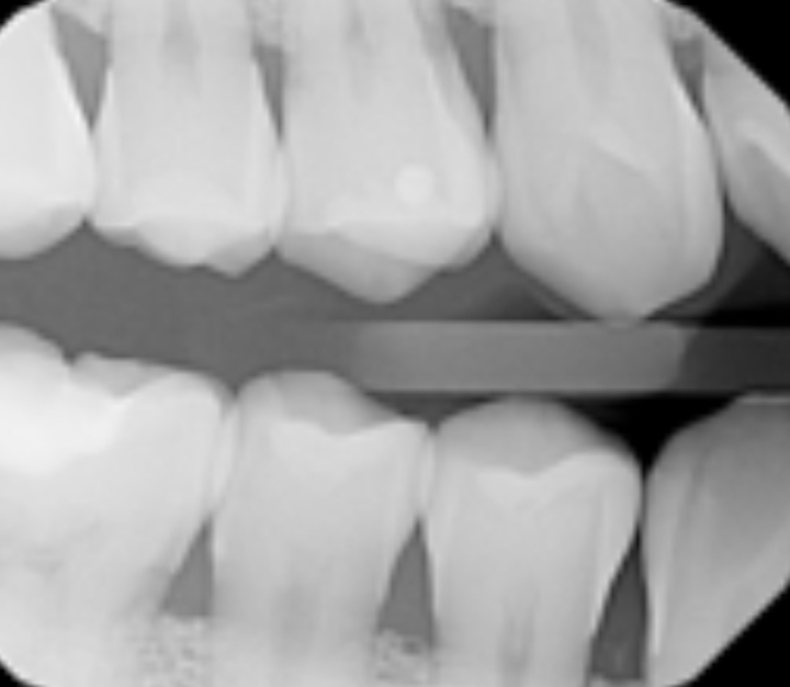 Thursday Troubleshooter Is there a dental code to reduce newpatient