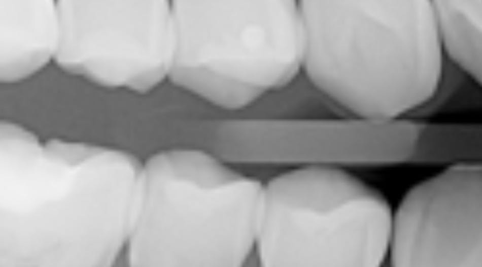 Thursday Troubleshooter: Is there a dental code to reduce new