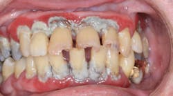 Content Dam Diq Online Articles 2017 08 17aug3bcednote Thumb Content Dam Diq Online Articles 2017 08 17aug3bcednote Thumb