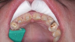 Content Dam Diq Online Articles 2017 08 17aug3bcjohnson Thumb Content Dam Diq Online Articles 2017 08 17aug3bcjohnson Thumb