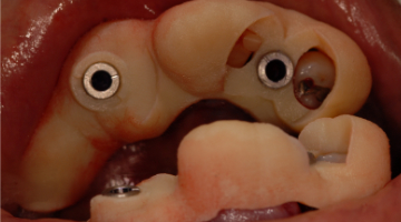 Content Dam Diq Online Articles 2017 08 17aug3bcpaghdiwala Thumb