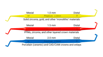 Imaginary Dental Crowns Before And After Tooth Fairy Teethwhiteningservice Dentalcrownsbeforeandafterlasv Dental Crowns Before And After Las Vegas Dental Crowns Dental Tooth Extraction Care