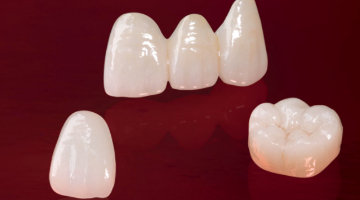 Content Dam Diq Online Articles 2017 08 E max 1