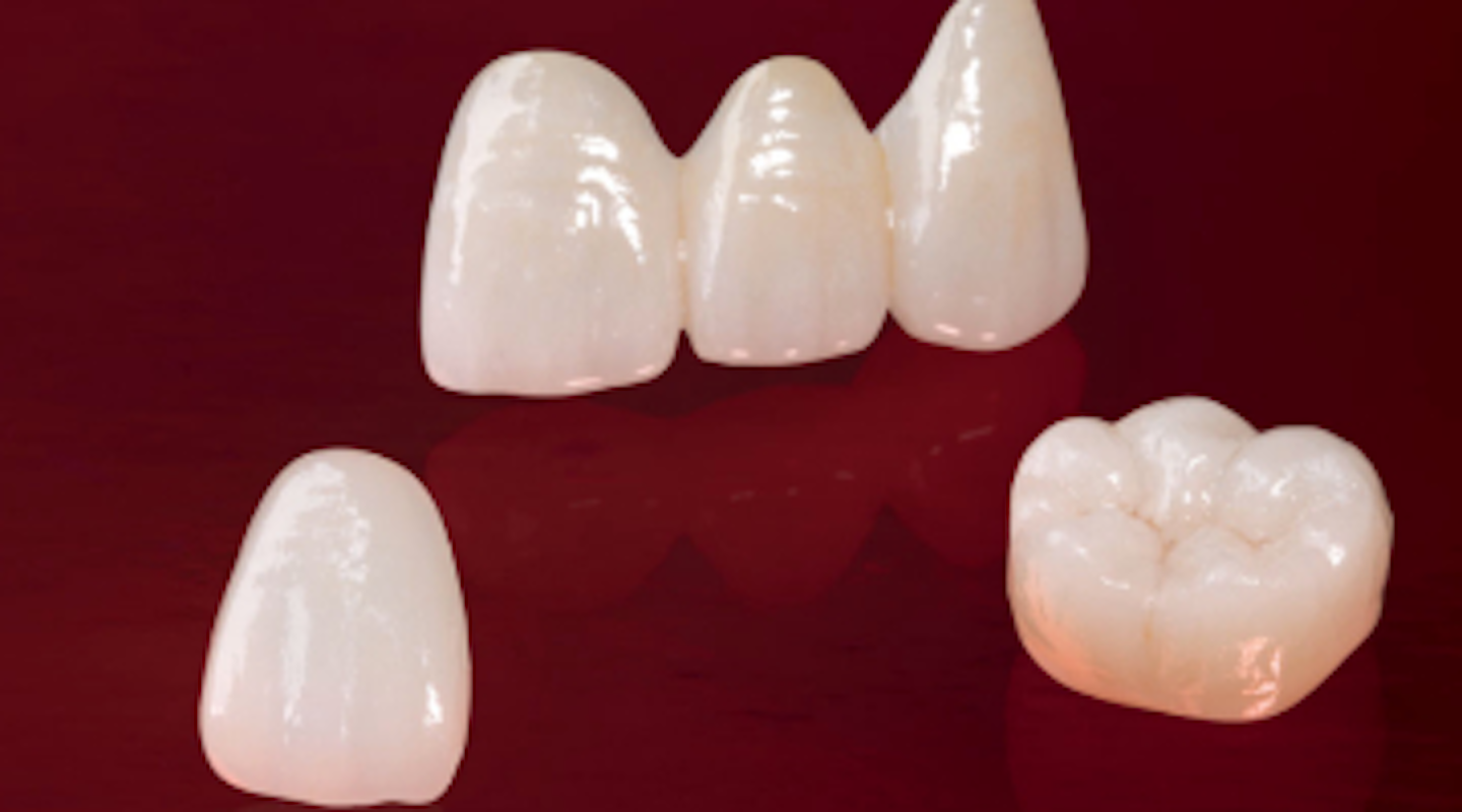 Thursday Troubleshooter Different codes for zirconia crowns vs. e.max