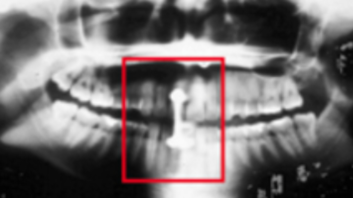 Content Dam Diq Online Articles 2017 08 Jeong X Ray 1