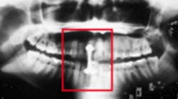 Content Dam Diq Online Articles 2017 08 Jeong X Ray 1 Content Dam Diq Online Articles 2017 08 Jeong X Ray 1
