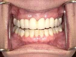 170915evicol P01 170915evicol P01