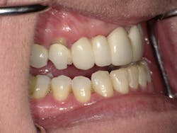 170915evicol P02 170915evicol P02