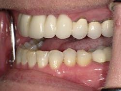 170915evicol P03 170915evicol P03