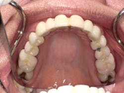 170915evicol P04 170915evicol P04