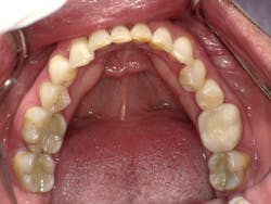 170915evicol P05 170915evicol P05