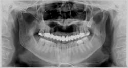 170915evicol P08 170915evicol P08