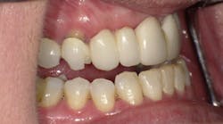 Content Dam Diq Online Articles 2017 09 170915evicol Thmb 360 Content Dam Diq Online Articles 2017 09 170915evicol Thmb 360