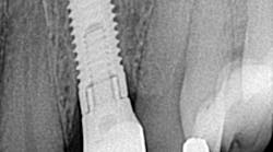 Content Dam Diq Online Articles 2017 09 17sept7bcednote Thumb Content Dam Diq Online Articles 2017 09 17sept7bcednote Thumb