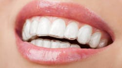 Content Dam Diq Online Articles 2017 09 Clear Aligner 1 Content Dam Diq Online Articles 2017 09 Clear Aligner 1
