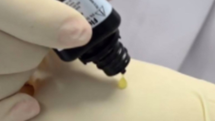 Content Dam Diq Online Articles 2017 09 Olson Fluoride Varnish Glove Diqthumb