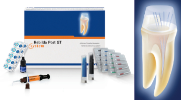 Content Dam Diq Online Articles 2017 09 Voco Rebilda Post Gt Diqthumb