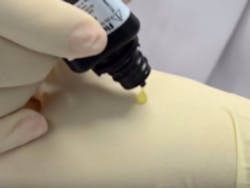 Olson 02 Pascal Fluorilaq Squeeze Fluoride Varnish Olson 02 Pascal Fluorilaq Squeeze Fluoride Varnish