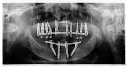 Figure 1 Figure 1