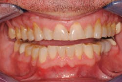 17oct5bchedlund P01 17oct5bchedlund P01