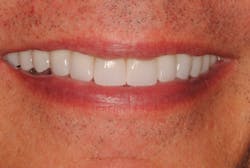 17oct5bchedlund P05 17oct5bchedlund P05