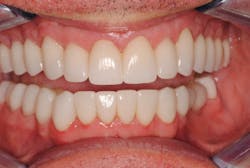 17oct5bchedlund P06 17oct5bchedlund P06