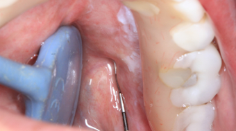 Second North American Dental Hygiene Research Conference Getting