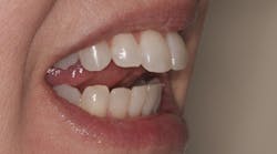 Content Dam Diq Online Articles 2017 11 17nov2bcednote Thumb Content Dam Diq Online Articles 2017 11 17nov2bcednote Thumb