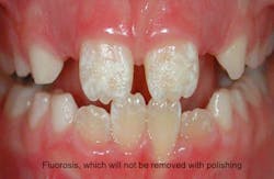 Jeong Polishing Jeong Polishing