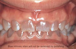 Jeong Polishing 1 Jeong Polishing 1