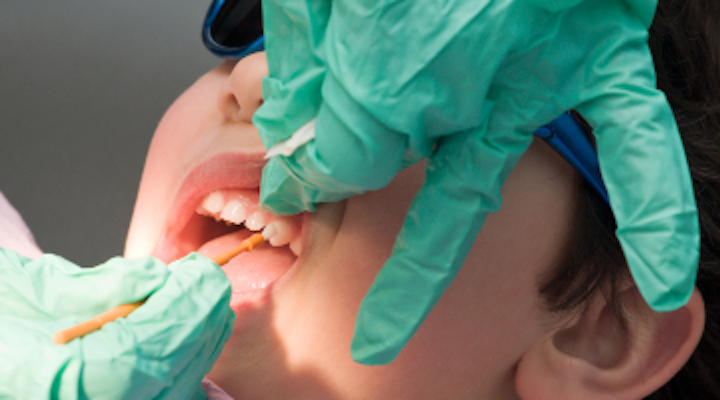 What To Consider When Choosing A Fluoride Varnish Part 2 Dentistryiq